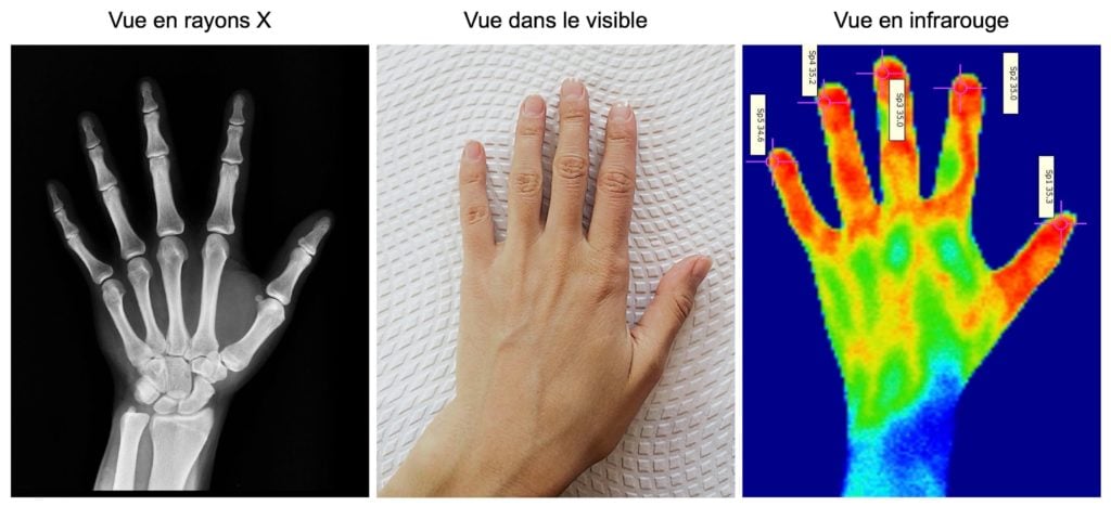 À gauche, radio d'une main : on observe les os. Au milieu, photo d'une main. À droite, main qui apparaît sous plusieurs couleurs sur un fond bleu foncé : du bleu au niveau du poignet, du vert au niveau du dos et du rouge au niveau des doigts. 